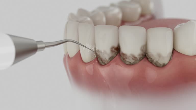Trusted Tooth Extraction service in Sugar Hill, GA - Dentist Open Now